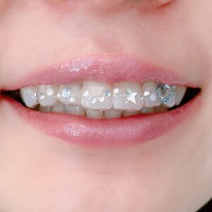 トゥースジェム No.1